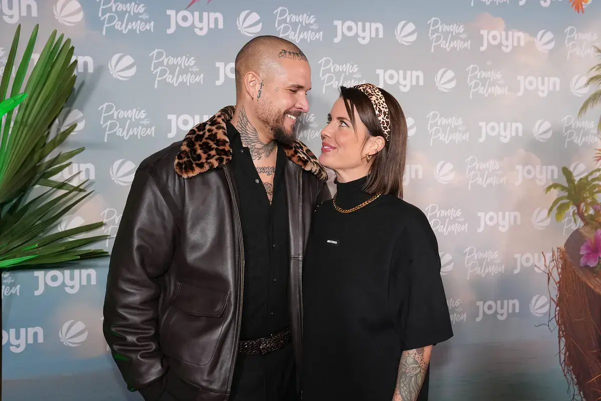 Nach Bart-Transplantation: Zico Banach überrascht mit offenem Geständnis